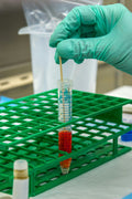 🧪 24 Hours Urinary Uric Acid Test