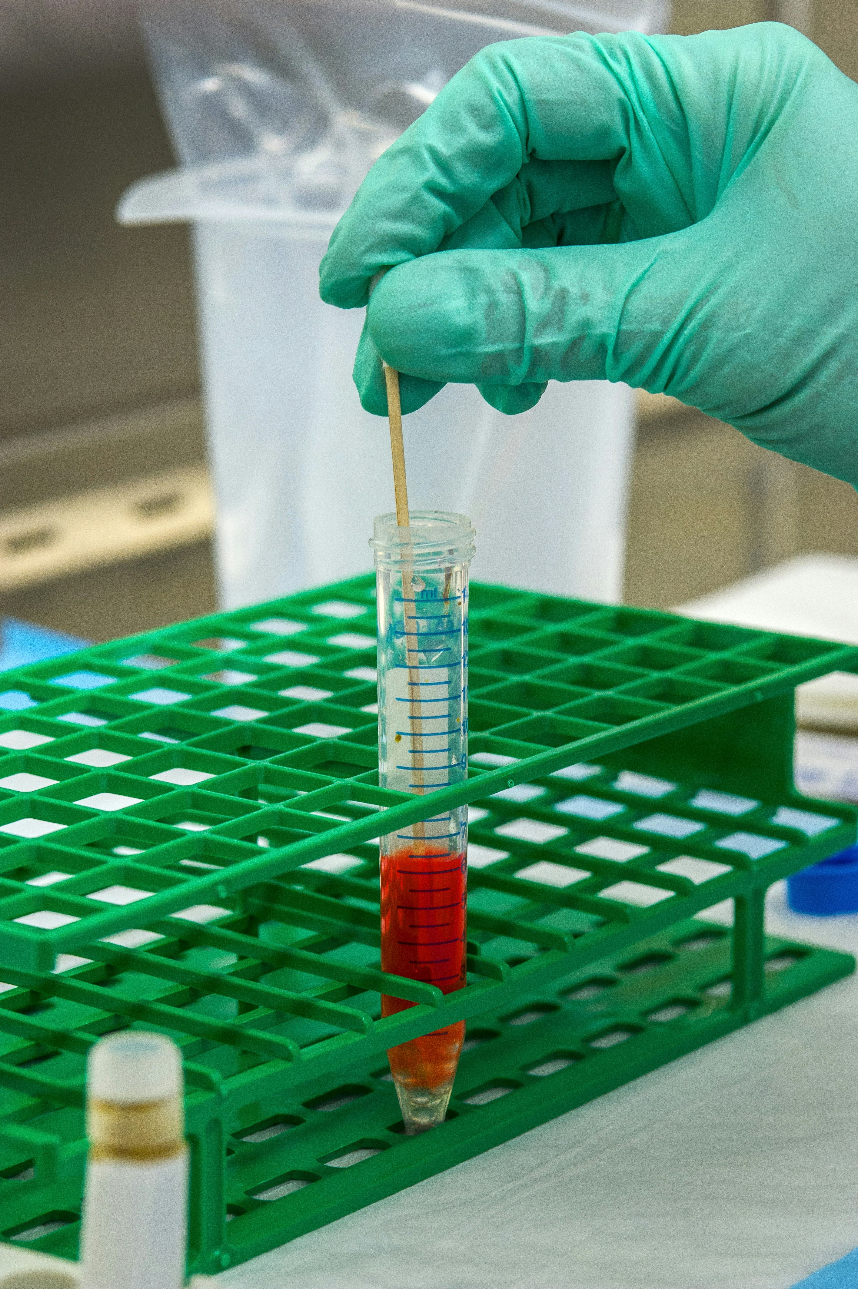 🧪 24 Hours Urinary Uric Acid Test