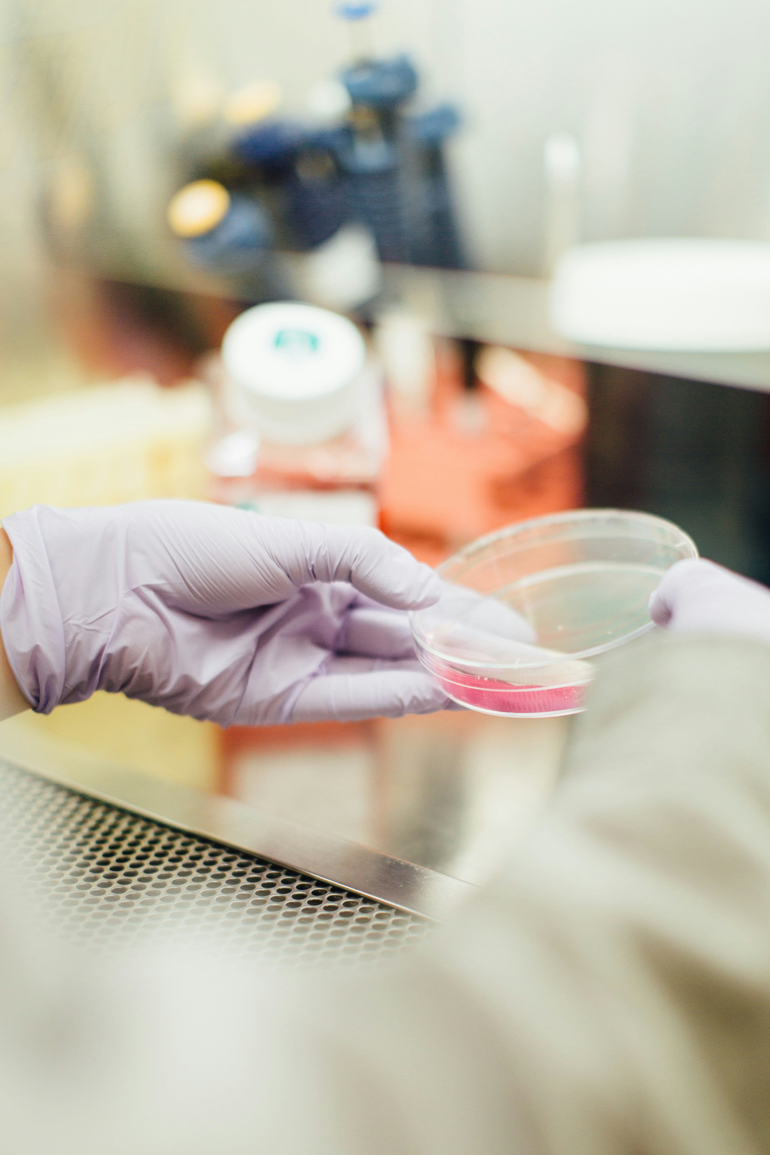 🧪 24 Hours Protein Creatinine Ratio (PCR) Test